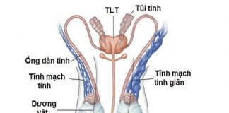 Cảnh báo giãn tĩnh mạch thừng tinh gây vô sinh ở nam giới