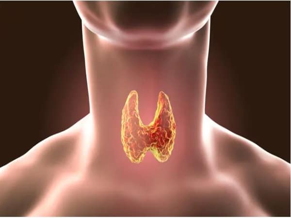Bệnh tuyến giáp là một trong số nguyên nhân gây rối loạn kinh nguyệt